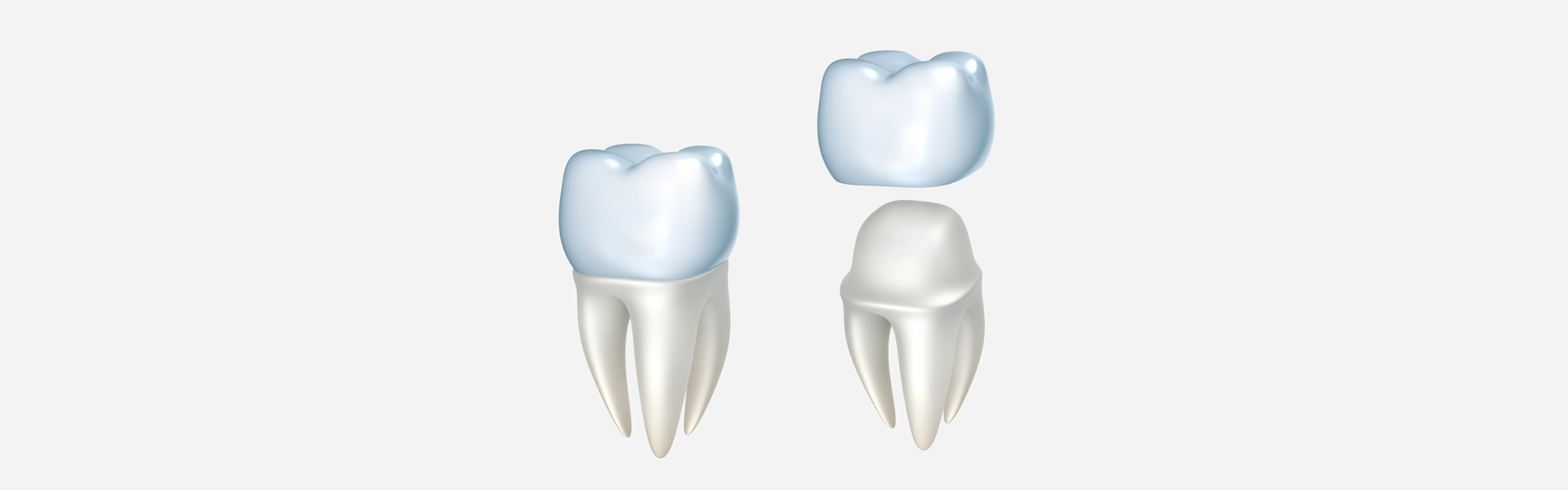 Dental Crowns
