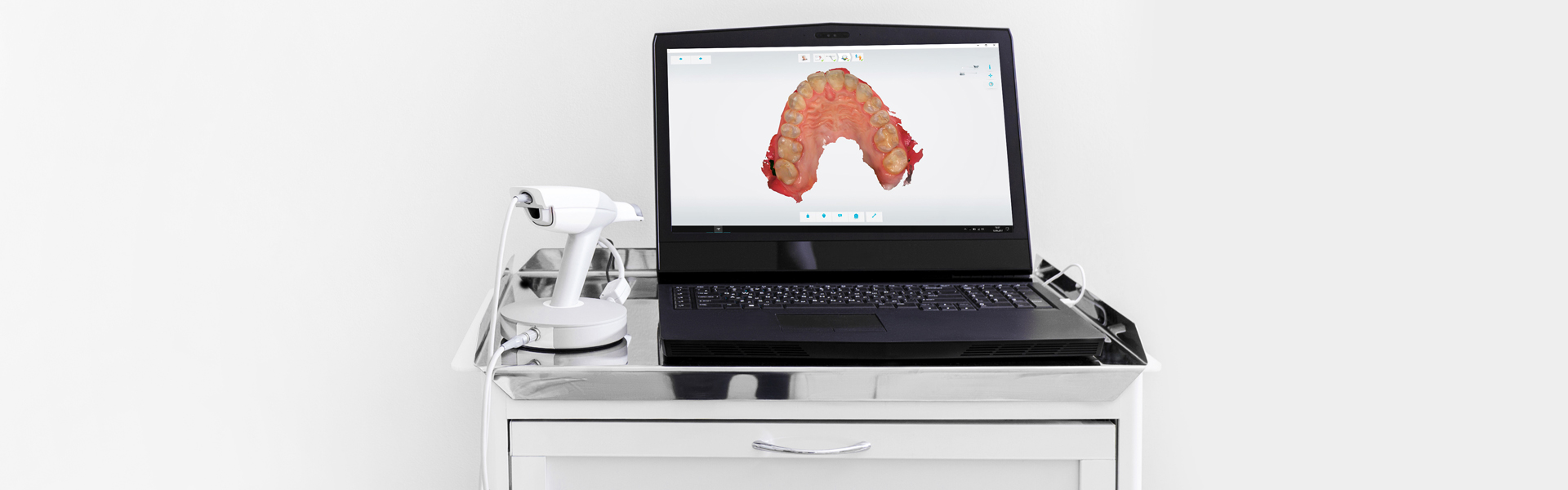 Intraoral Scanner